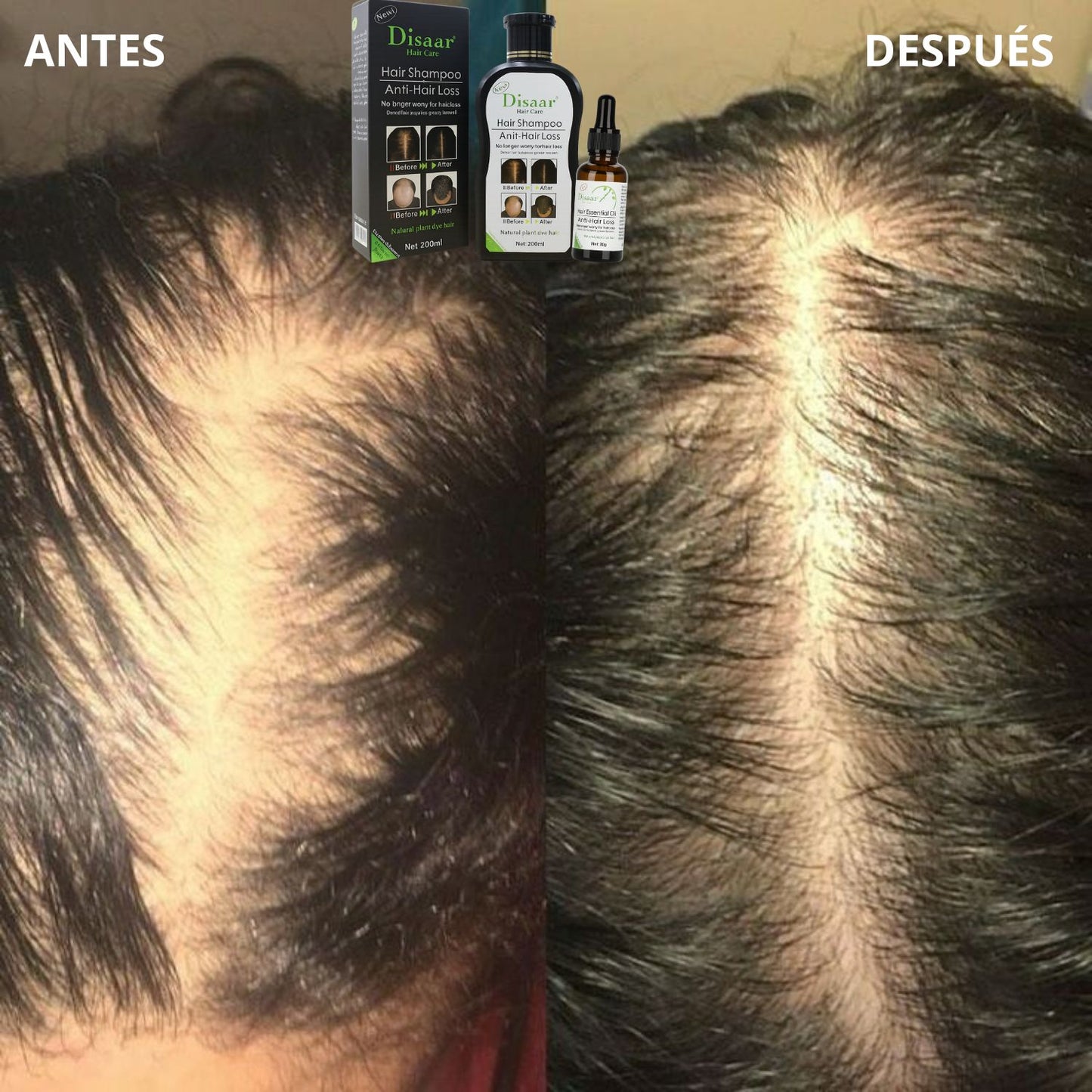Combo Anticaída Disaar – Shampoo + Serum 200 ML